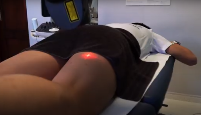 Tratamiento con laserterapia
